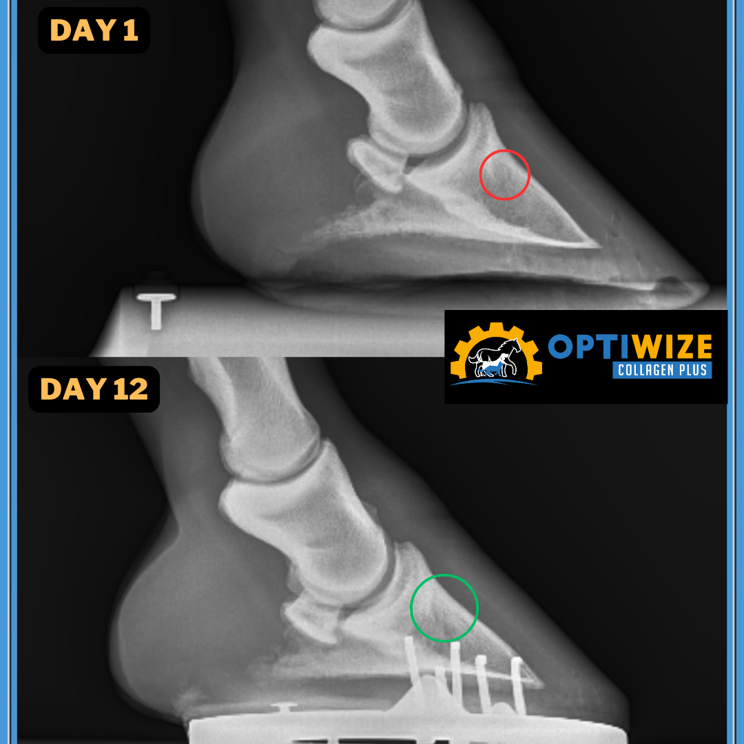 an x - ray of a foot