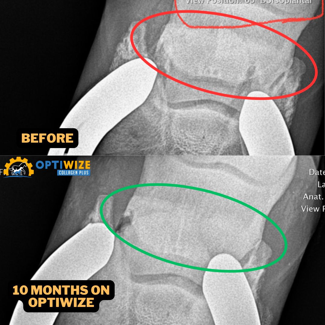 Spine X-rays: Before & 10 Months