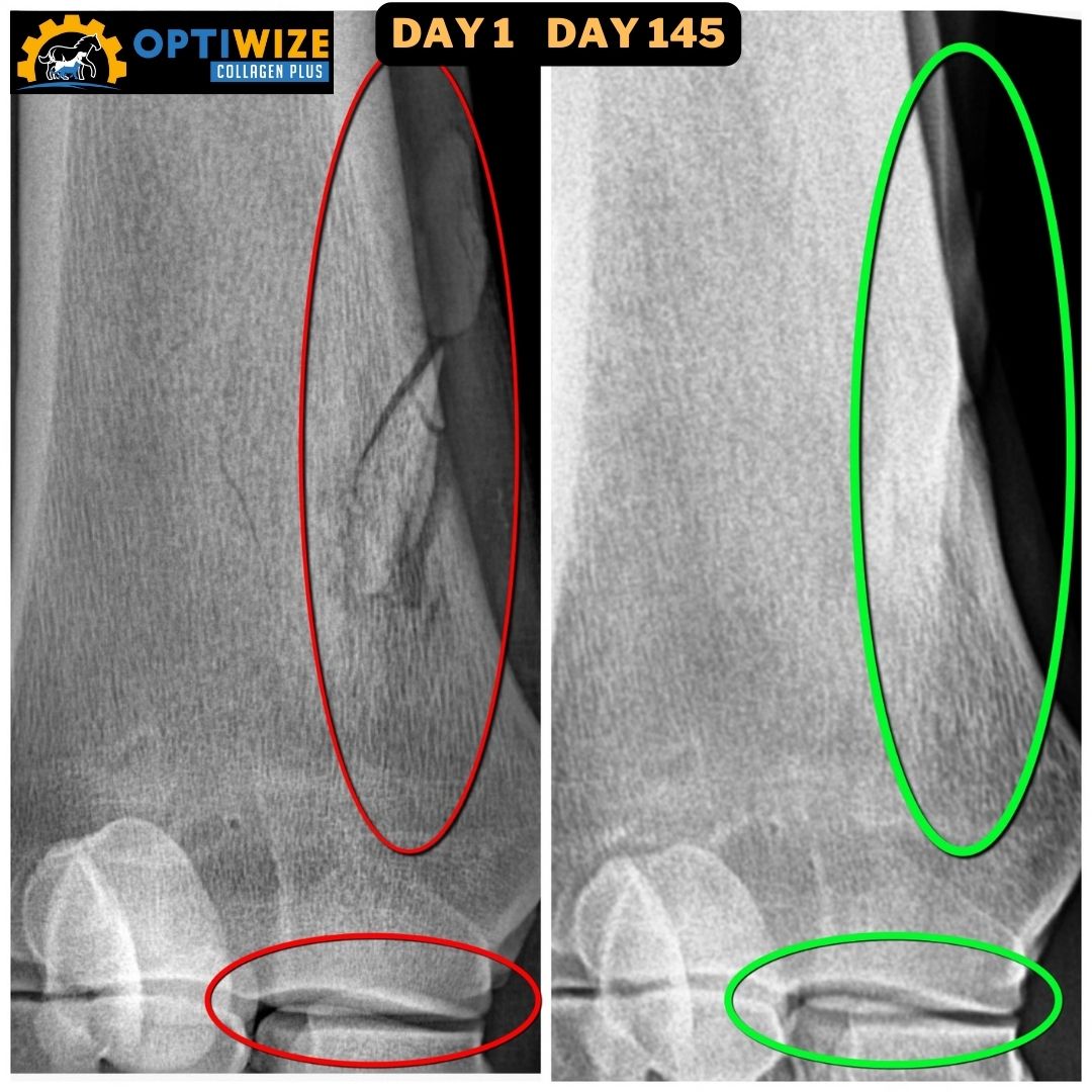 X-ray, fracture Day 1 vs. Day 145.