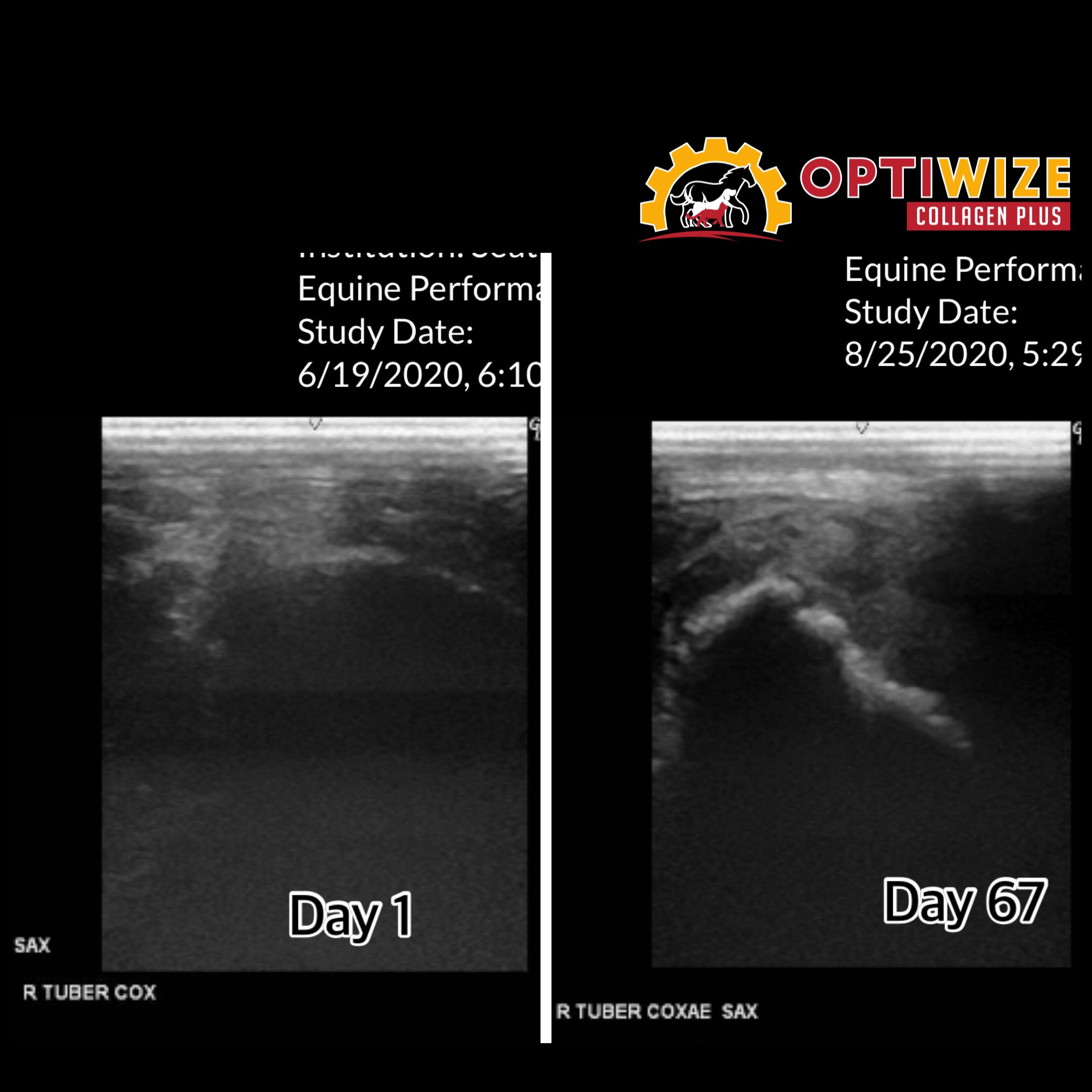 an x - ray of a woman's breast