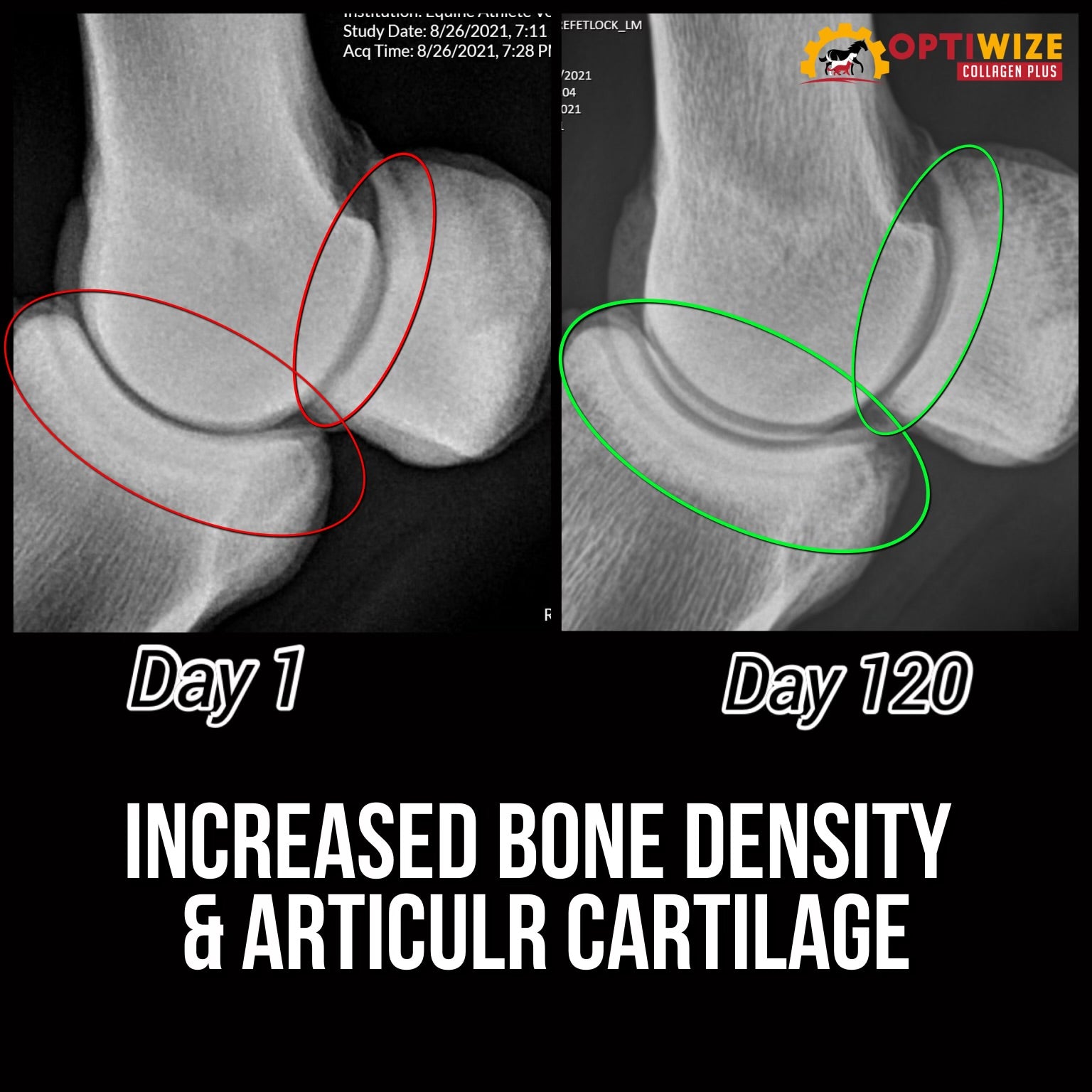 Joint X-ray, better density & cartilage, 120 days.
