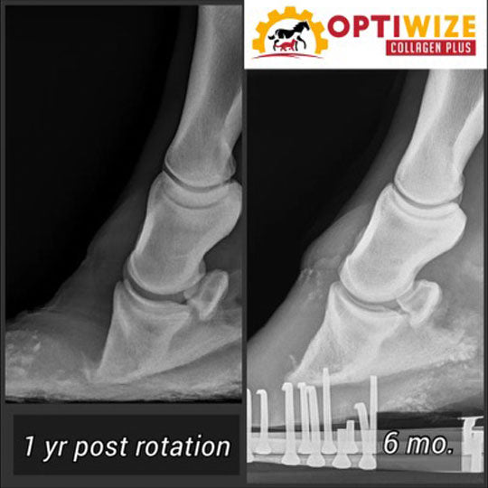 Legs, x-ray showing 1 year post rotation