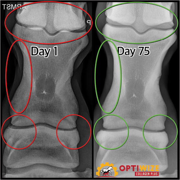 Knee healing: Day 1 vs. Day 75.