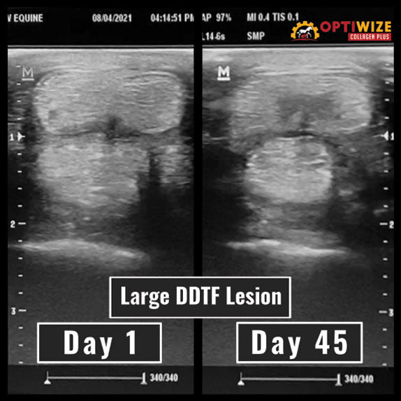 DDFT ultrasound comparison.