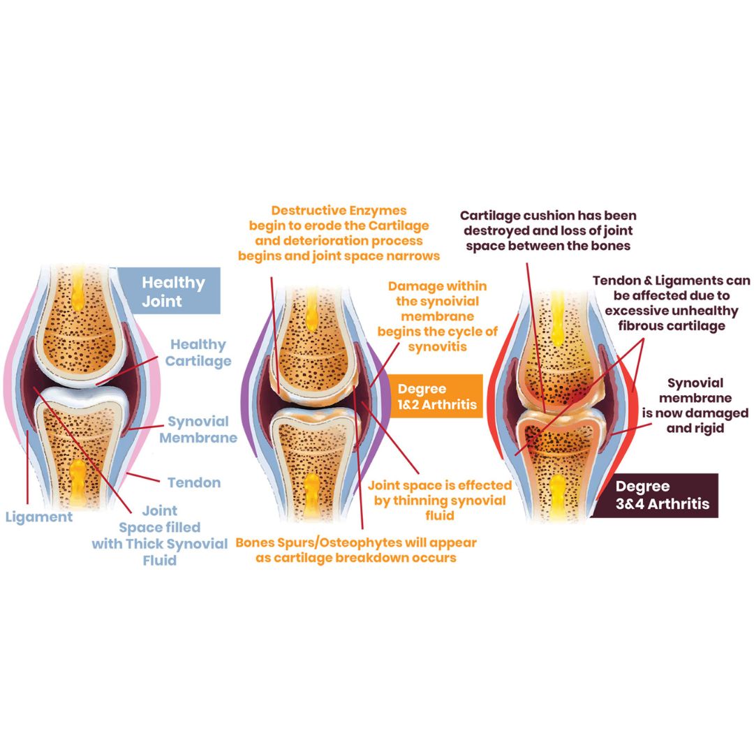 Do You Know What Degree Arthritis Your Horse Has OptiWize   Untitled Design 4 