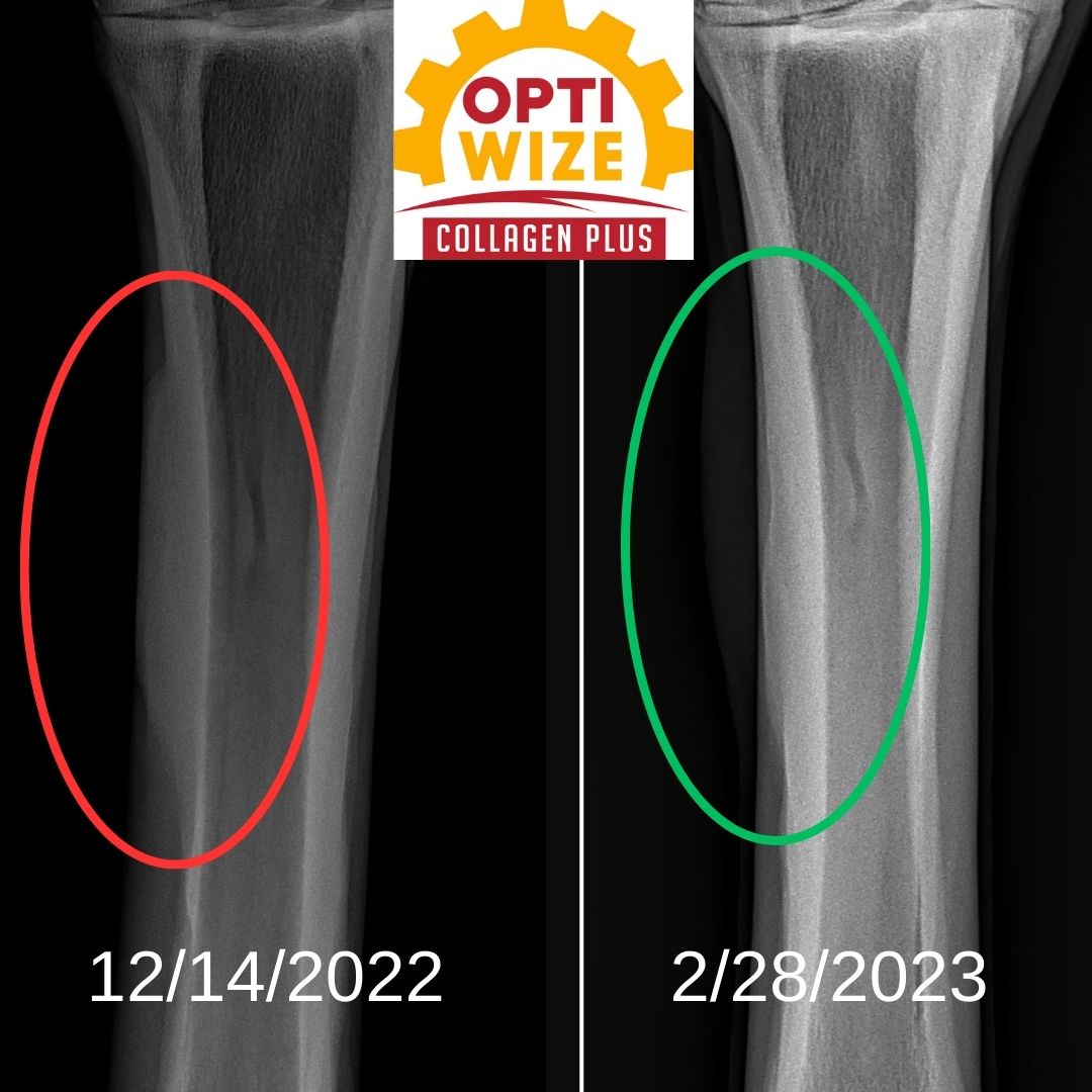 popped splint, fractured splint horses, splint rehab, horse splint